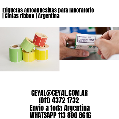 Etiquetas autoadhesivas para laboratorio | Cintas ribbon | Argentina